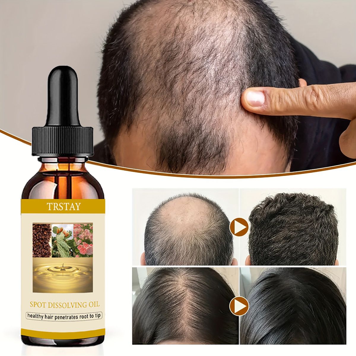 50ML Beard Growth Oil Anti Alo - Beard Oil ulasan dan harga