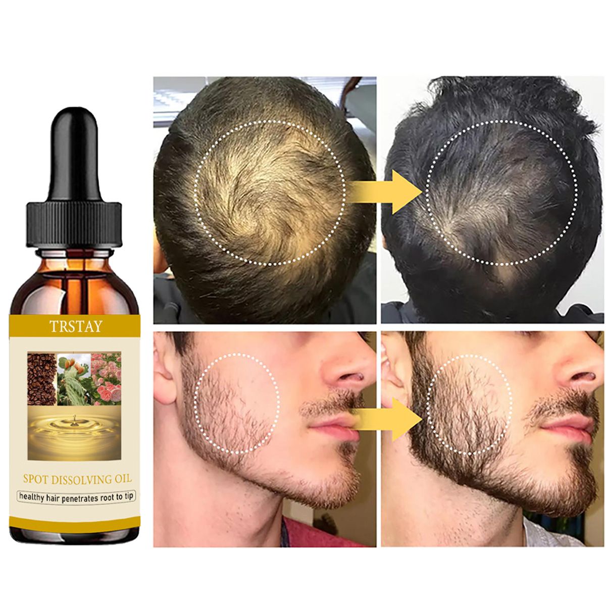 50ML Beard Growth Oil Anti Alo - Beard Oil ulasan dan harga