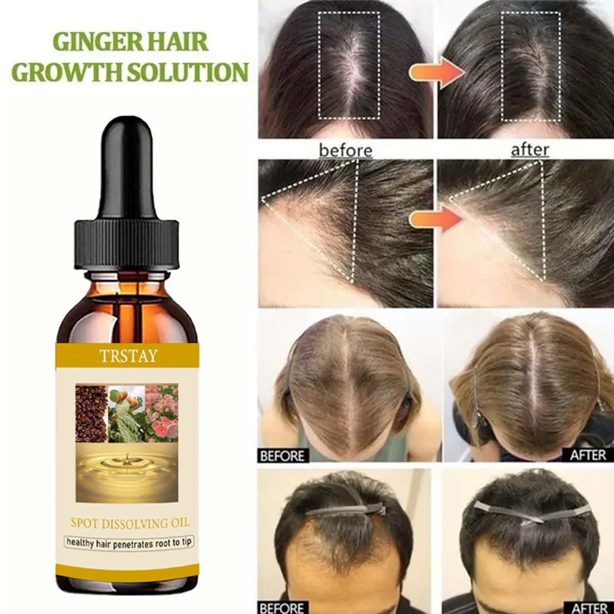 50ML Beard Growth Oil Anti Alo - Beard Oil ulasan dan harga
